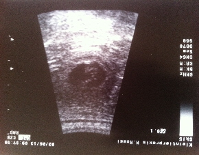 Ultraschall Bild von Goldendoodle Sheela am 30. Tag der Schwangerschaft