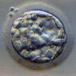 embryo6Blastozyst