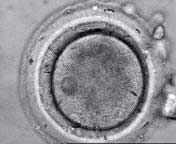embryo6Blastozyst2